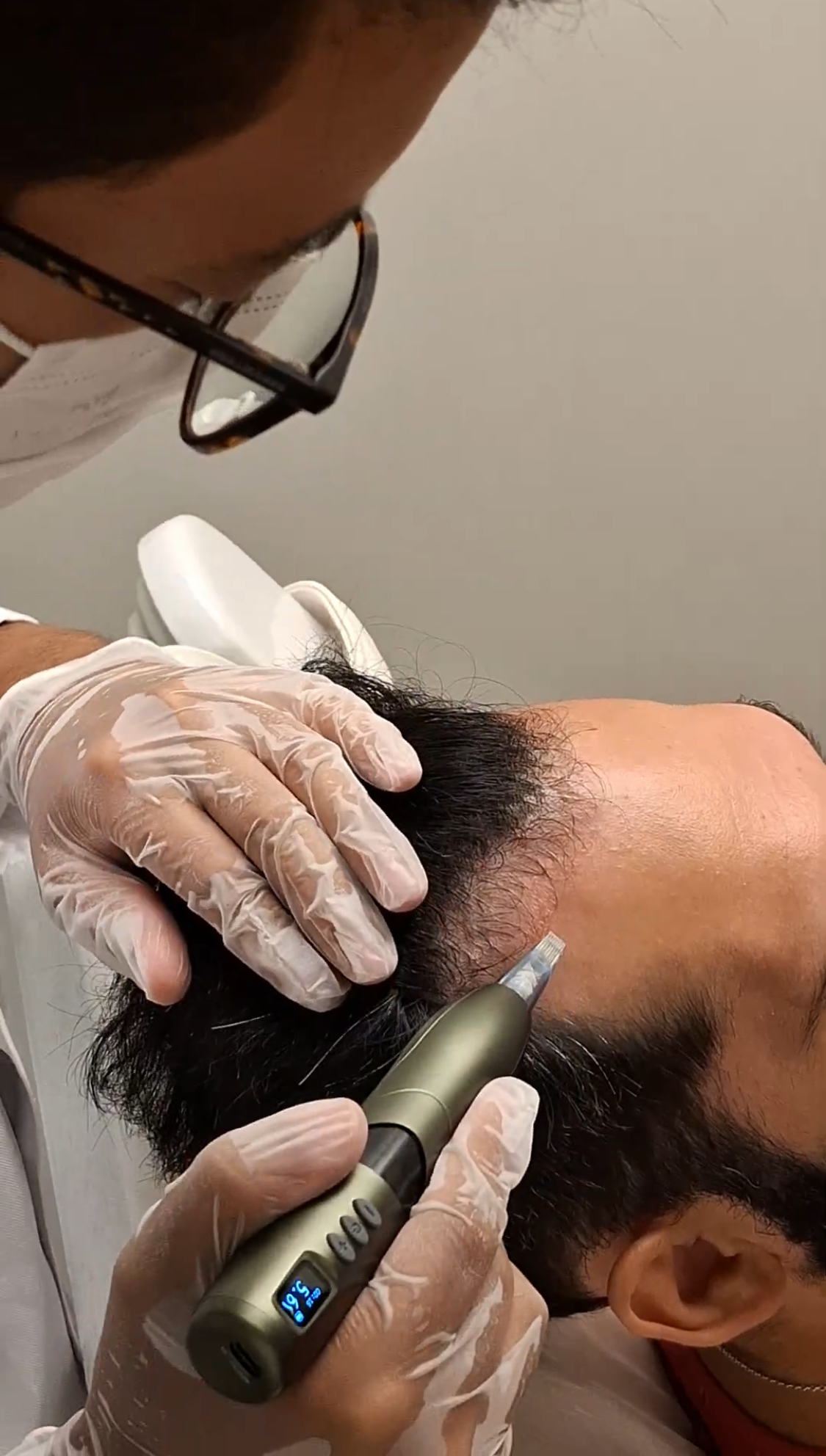 Microinfiltração, MMP e tratamentos avançados
